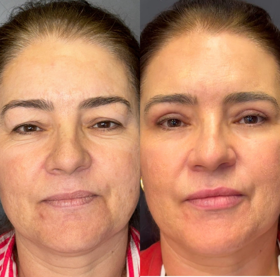 0238CE50-8493-47C4-B32D-DE50FA9634E5