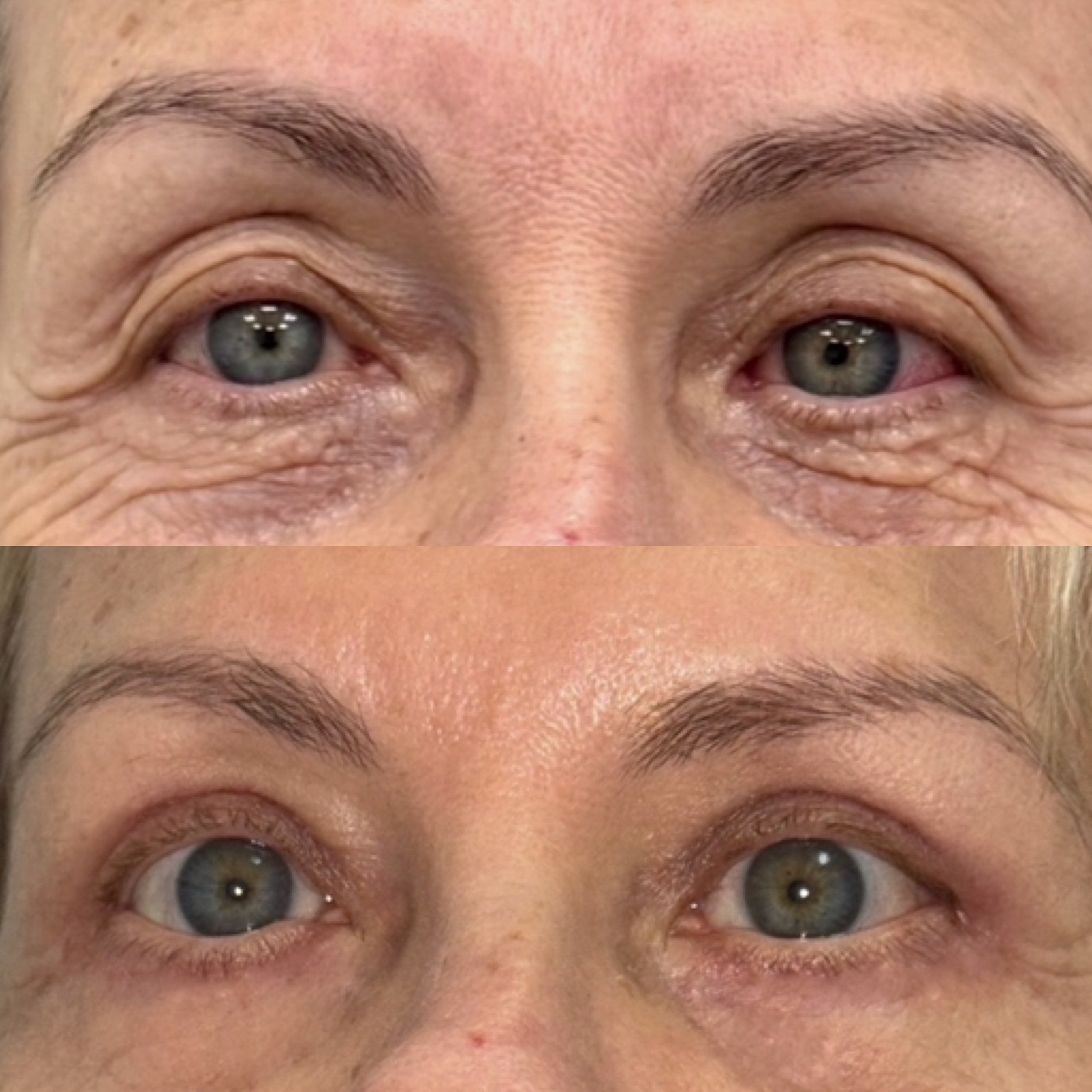 871EDC20-F498-40A5-A0D3-758A861565EC