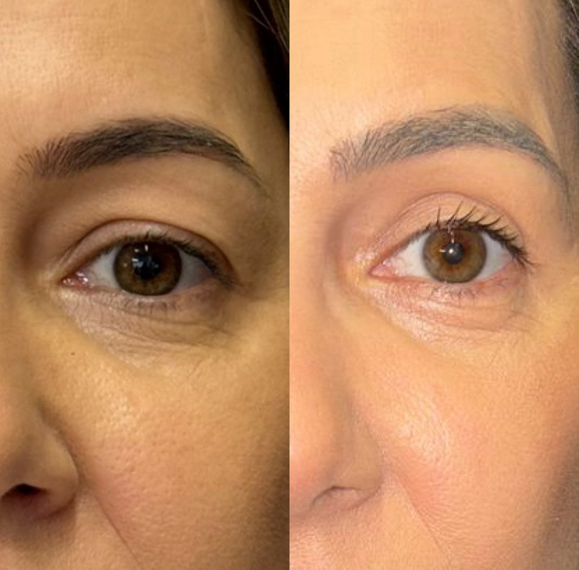 97060F24-BBB7-4DF8-BCB1-454276C1E0CC