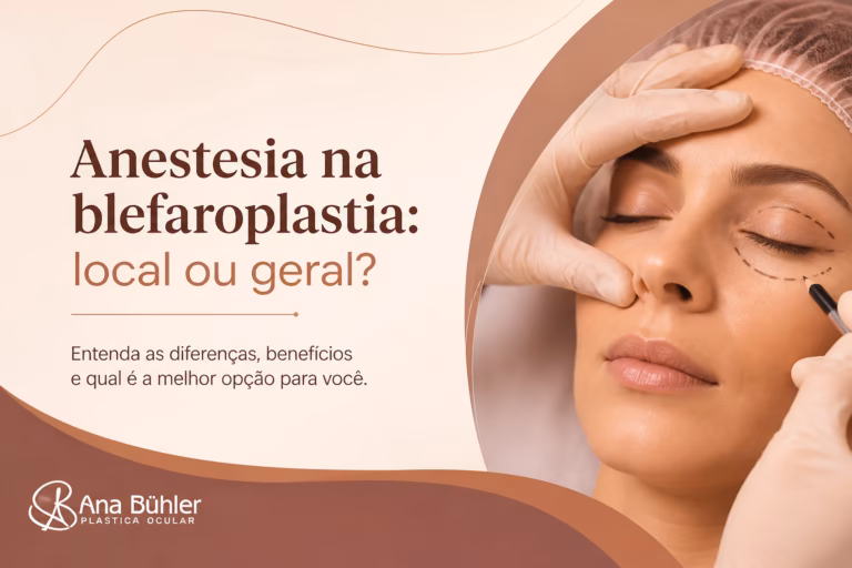 Representação esquemática das três modalidades de anestesia na blefaroplastia: local, sedação endovenosa e anestesia geral, com diferenças no nível de consciência e monitorização