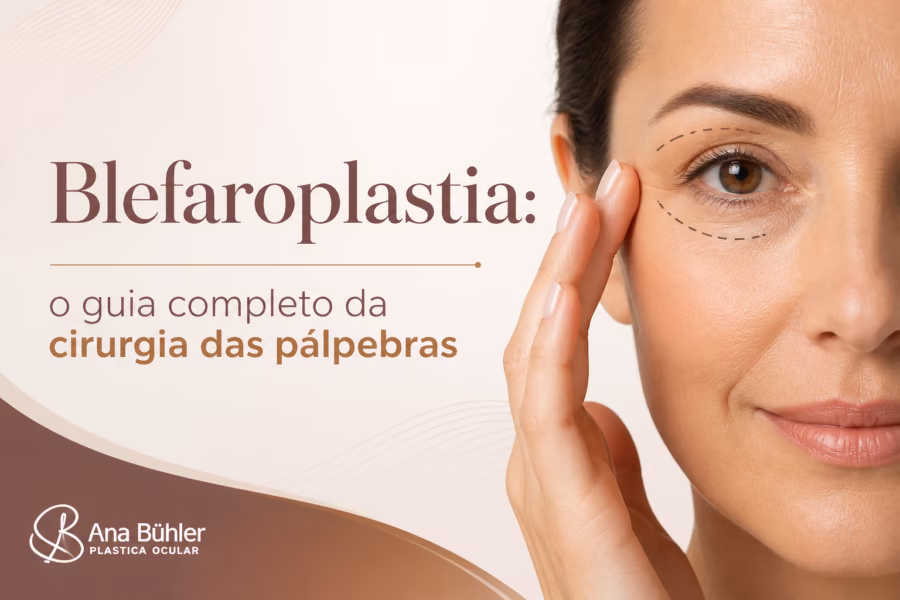 Diagrama ilustrativo mostrando as três variações de blefaroplastia: superior, inferior e combinada, com indicação das áreas tratadas em cada procedimento