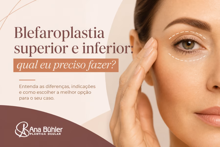 Ilustração didática comparando blefaroplastia superior, inferior e combinada nas estruturas da pálpebra