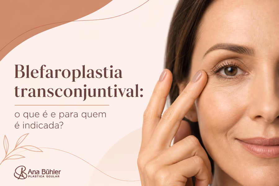 Diagrama anatômico da pálpebra inferior mostrando as lamelas e o acesso transconjuntival para blefaroplastia