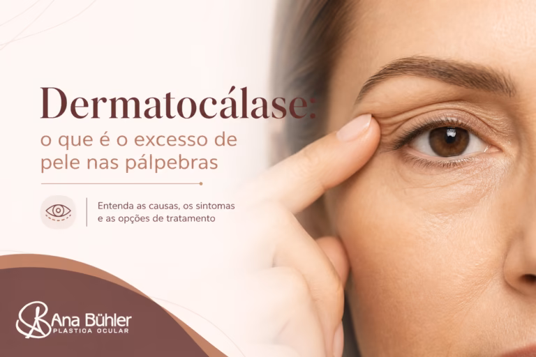 Ilustração comparativa mostrando as diferenças entre dermatocálase, ptose palpebral e pseudoptose na região das pálpebras