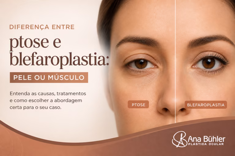 Comparação visual entre dermatocálase (excesso de pele na pálpebra) e ptose palpebral (pálpebra baixa por fraqueza do músculo levantador)