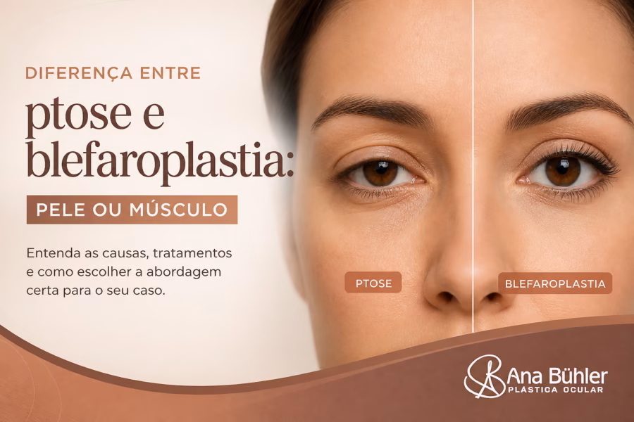 Comparação visual entre dermatocálase (excesso de pele na pálpebra) e ptose palpebral (pálpebra baixa por fraqueza do músculo levantador)