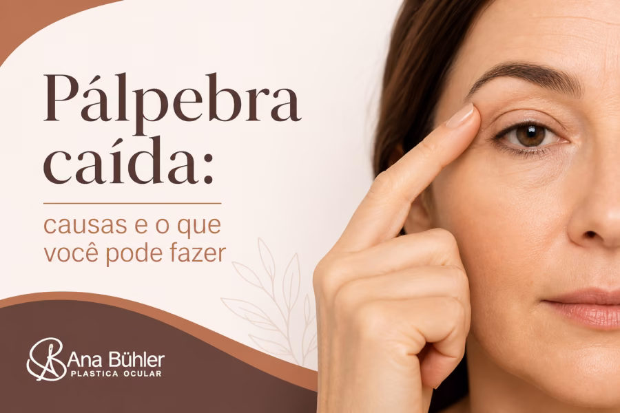 Comparação visual entre ptose (queda real da margem da pálpebra), dermatocálase (excesso de pele) e sobrancelha caída, mostrando como cada uma se parece no espelho