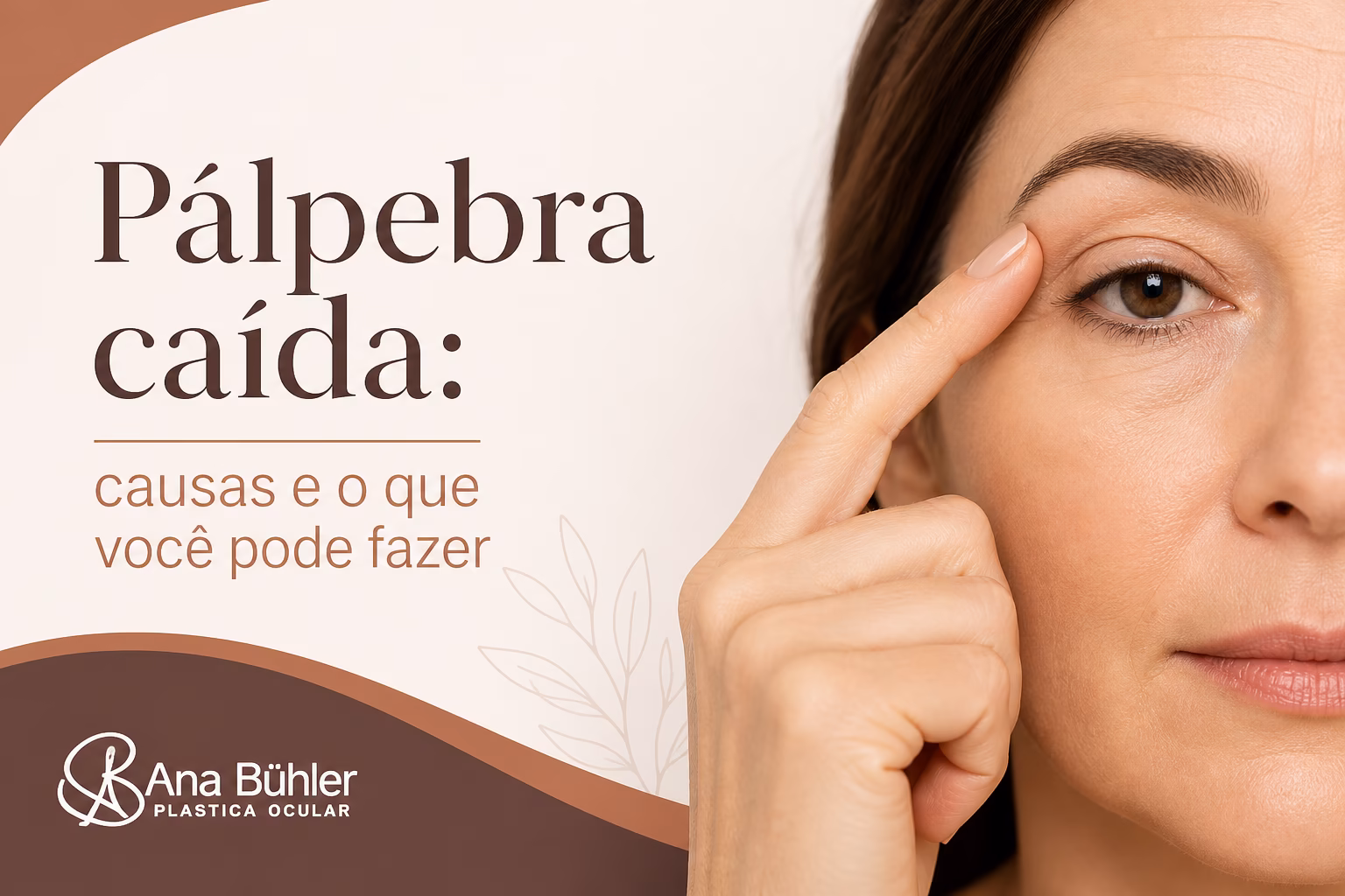 Comparação visual entre ptose (queda real da margem da pálpebra), dermatocálase (excesso de pele) e sobrancelha caída, mostrando como cada uma se parece no espelho